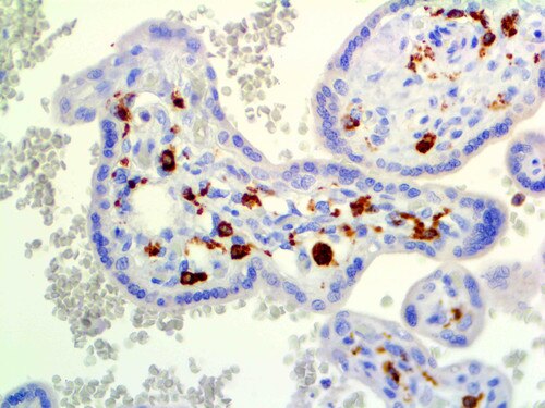 IHC of CD14 on an FFPE Placenta Tissue